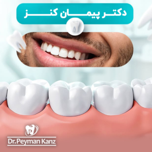 چرا بیماران برای درمان‌های زیبایی و ایمپلنت به دکتر پیمان کنز مراجعه می‌کنند؟
