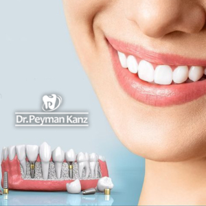 چرا پیدا کردن بهترین دندانپزشک در کرج اهمیت زیادی دارد؟