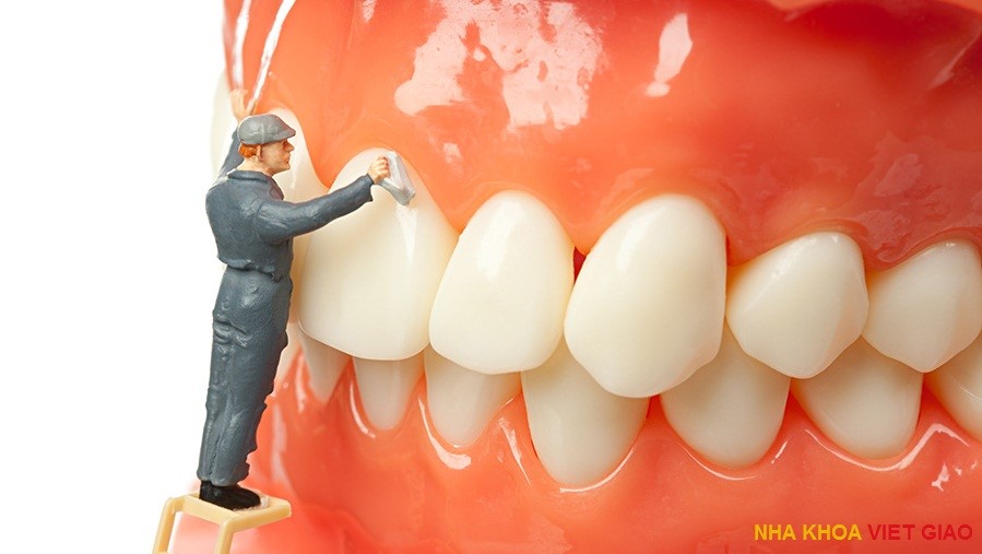 0 2 - جرم گیری دندان
