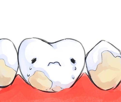 0 - پلاک دندان