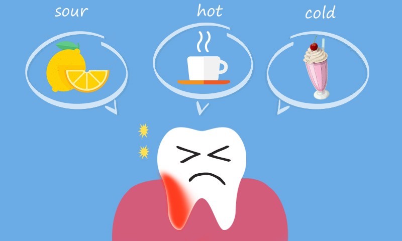 حساسیت دندان ها