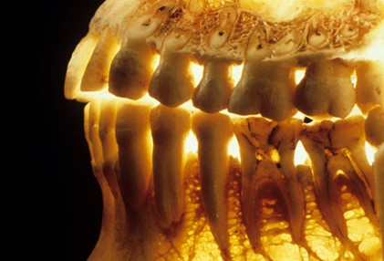 0 1 - پوکی استخوان و سلامت دهان و دندان