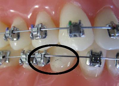  اورژانسی دندانپزشکی