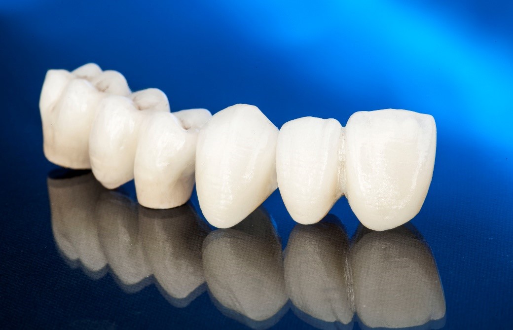 انتخاب نوع روکش دندان