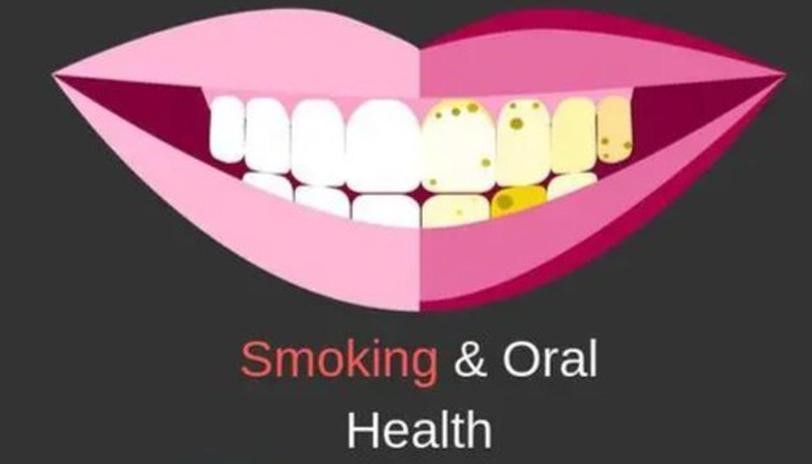 کشیدن سیگار و سلامت دهان
