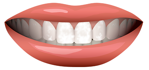 لکه دندان و درمان آن