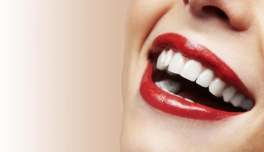40 - آیا قرار گرفتن ونیرها روی دندان ها نیاز به تراش دندان دارد؟