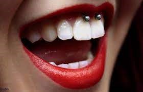 24 - تأثیرات منفی پیرسینگ ناحیه دهان