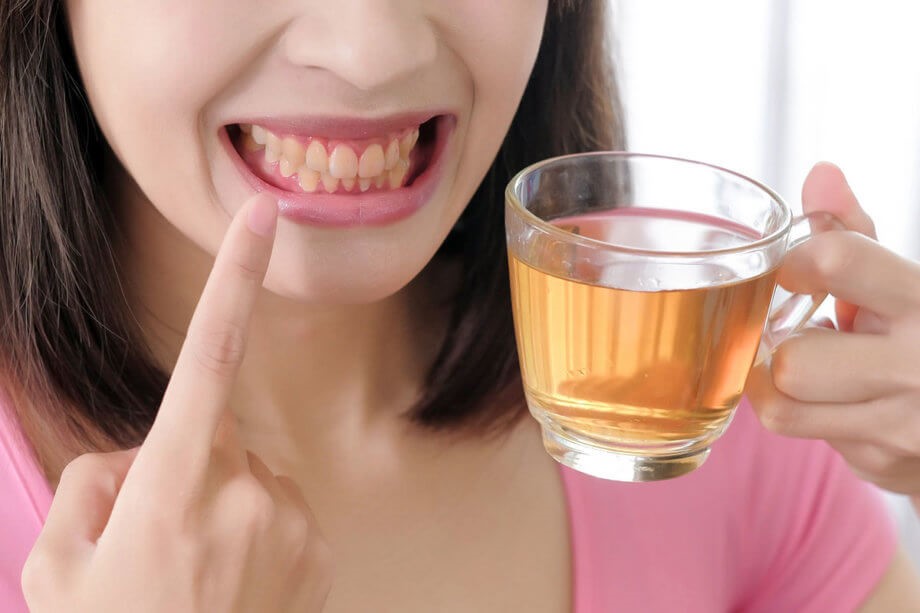 نوشیدنی مفید و مضر برای دندان