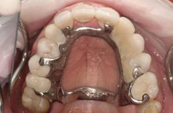 حساسیت به مواد دندانپزشکی