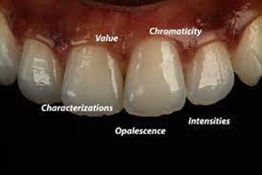 انواع کامپوزیت دندانی