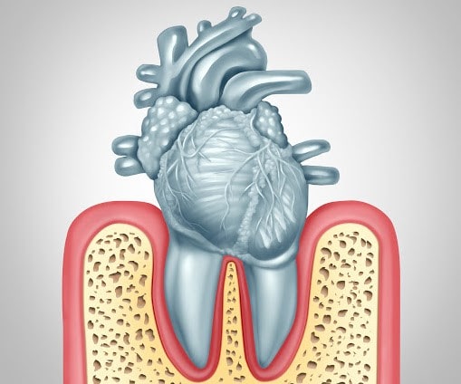 سلامت دهان و دندان ها و بیماری قلبی
