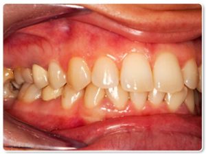 چگونه می توانم بفهمم که مشکلات دهانی ناشی از دیابت دارم؟