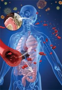 اختلالات خود ایمنی و سلامت دهان